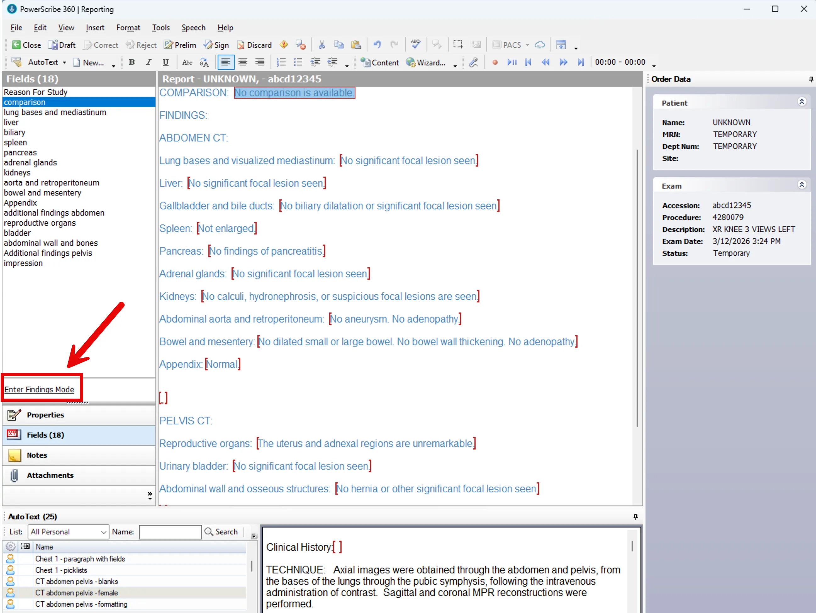 PowerScribe report with CT Abdomen and Pelvis template loaded, Fields tab visible on the left