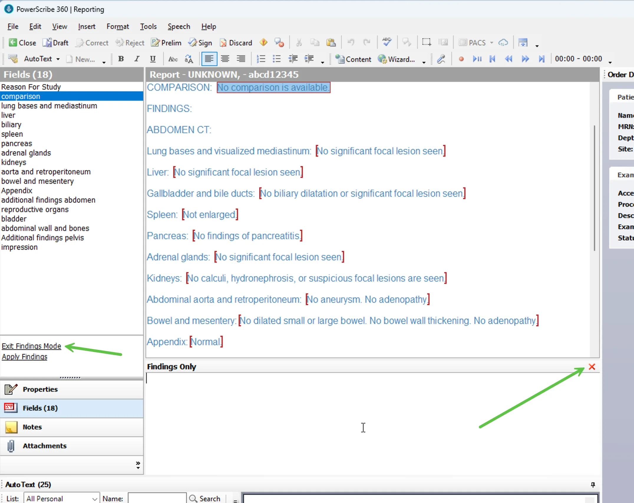 PowerScribe with Findings Only panel open and empty, ready for input