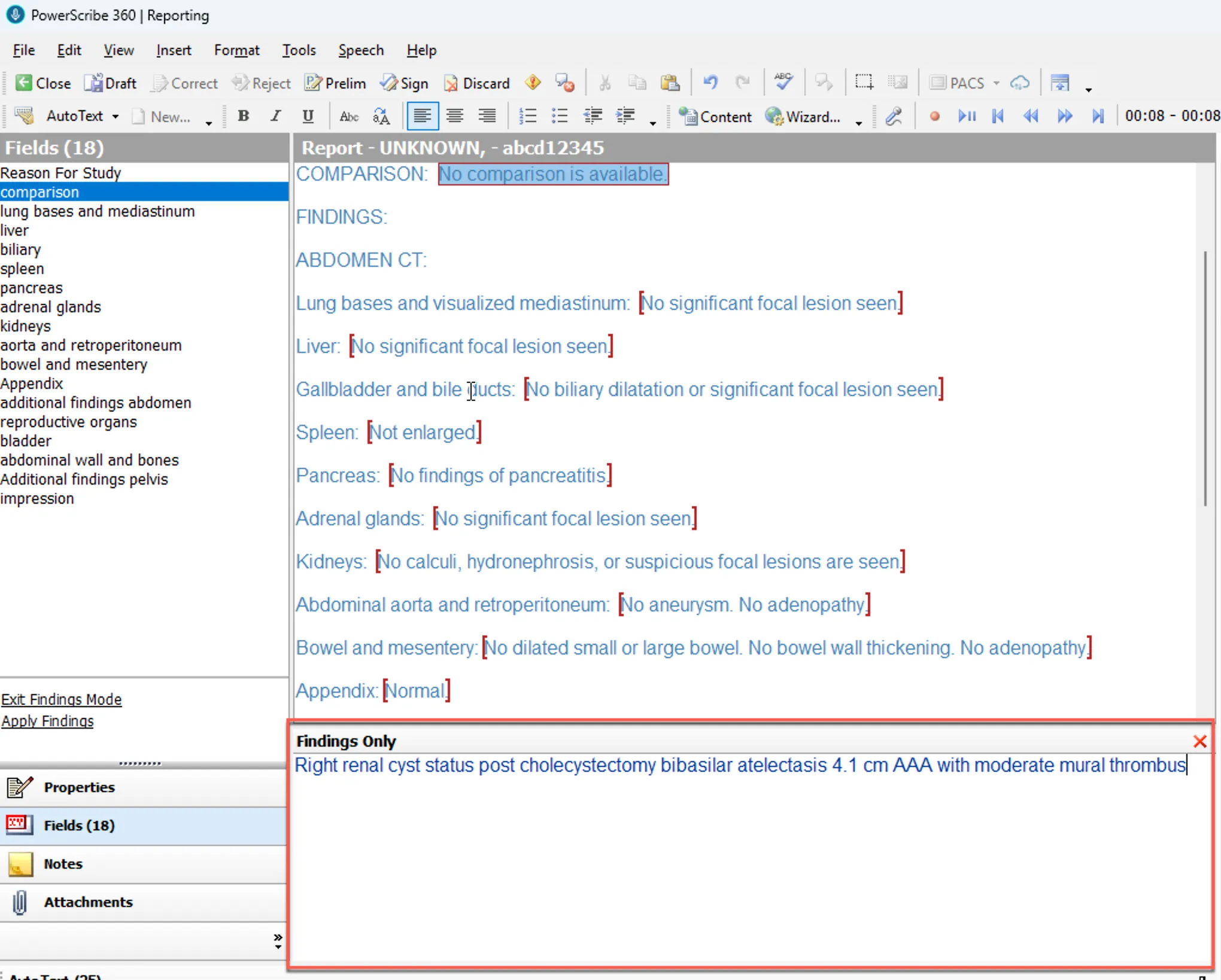 Findings Only panel with sample findings entered