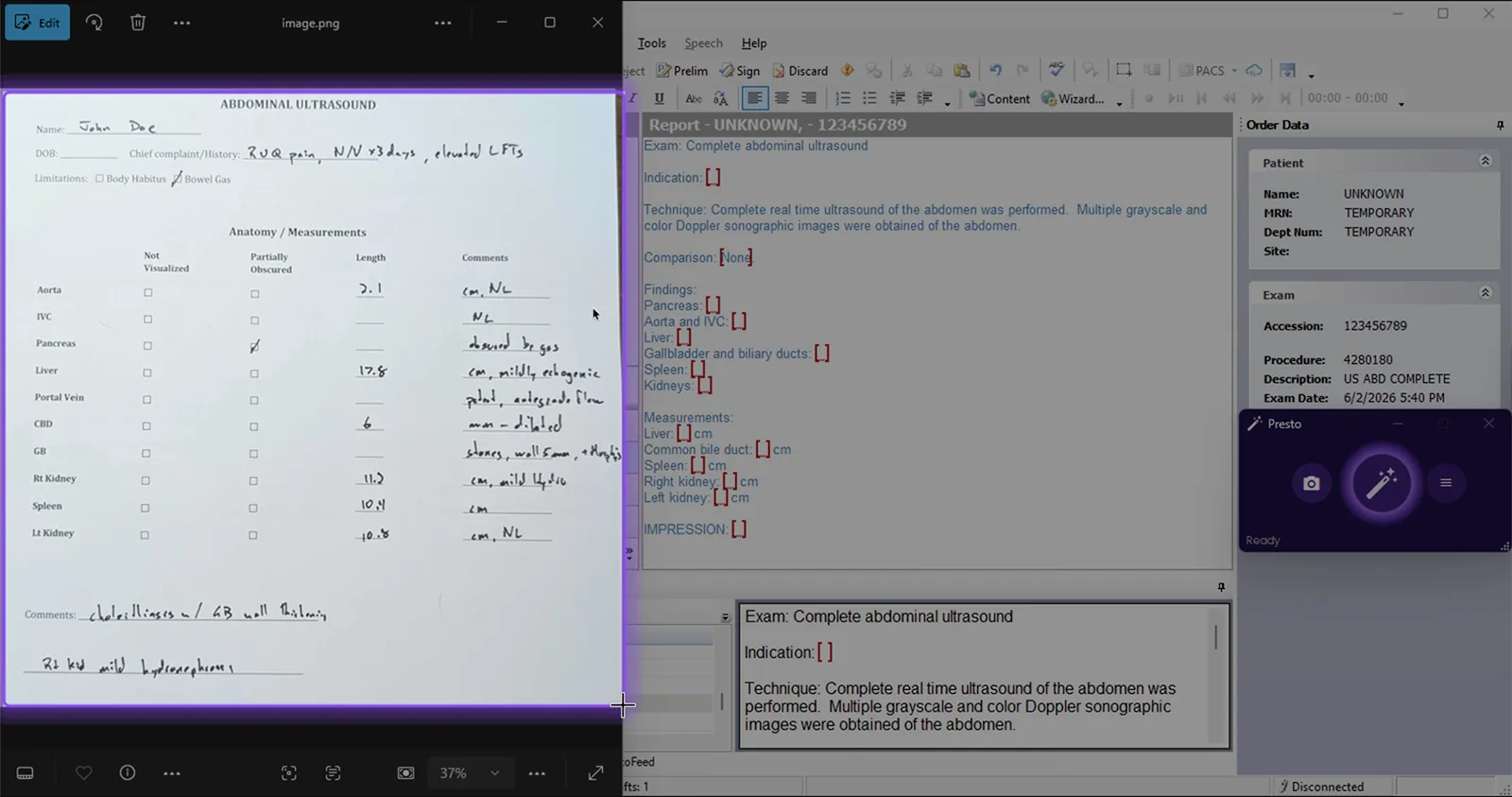 Full screen showing region selection bounding box drawn around a handwritten ultrasound sonographer worksheet, with PowerScribe report and Presto widget visible