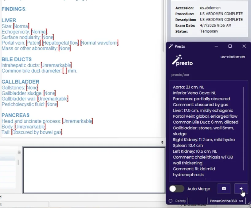 Presto widget populated with extracted measurements alongside the PowerScribe report