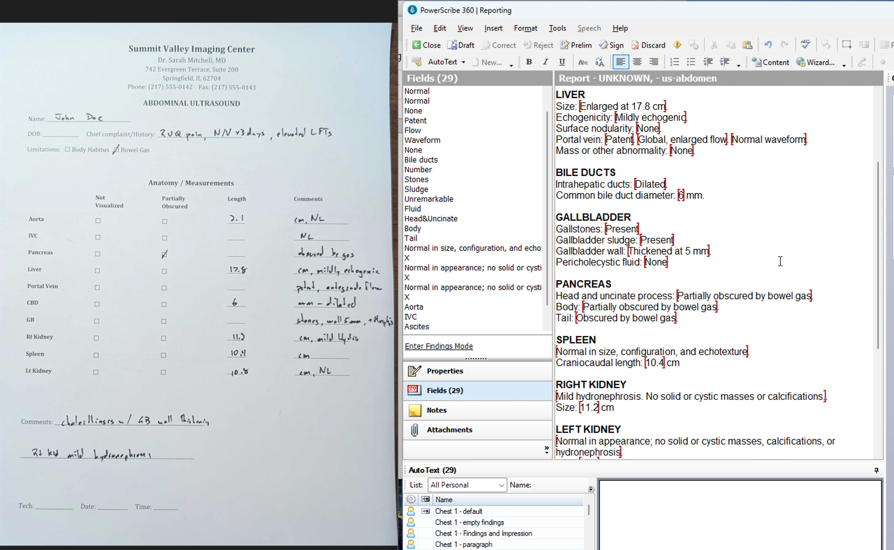 PowerScribe report with measurement fields populated from OCR extraction, tech worksheet visible on the left