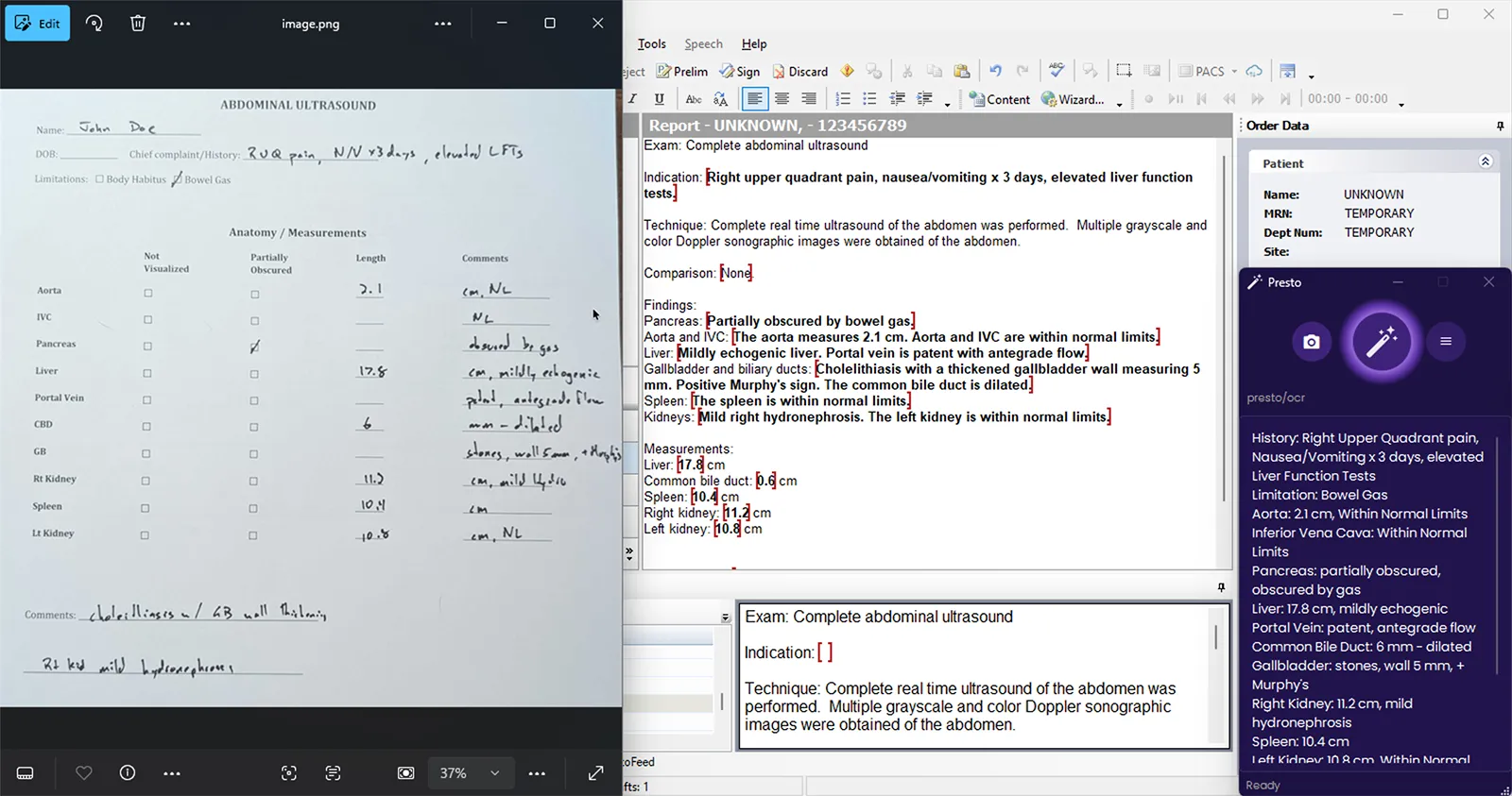 PowerScribe report with measurement fields populated from OCR extraction, sonographer worksheet visible on the left